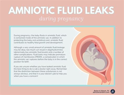 pregnant leaking fluid|Leaking Amniotic Fluid while Pregnant: Causes, Signs。